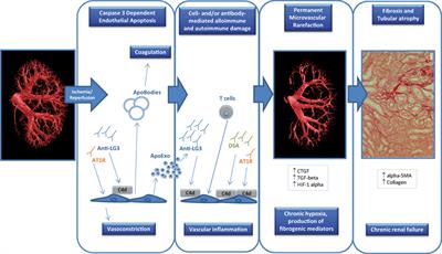 Endothelial Dysfunction in Kidney Transplantation